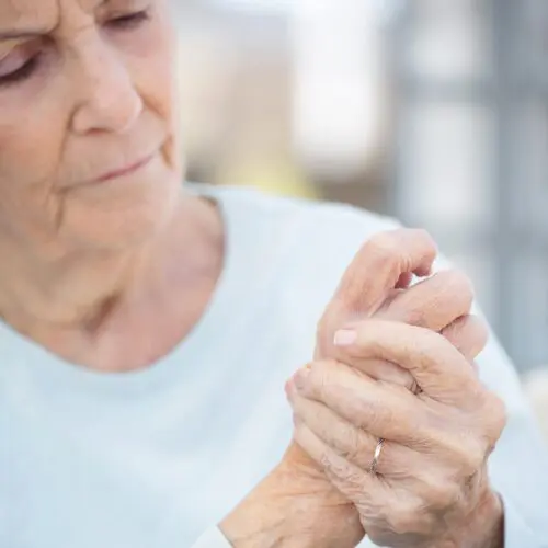 Rheumatoid Arthritis Profile