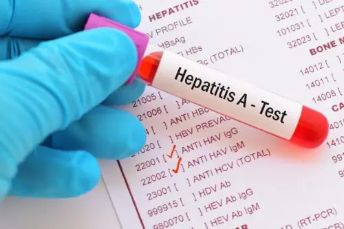 Hepatitis A, ab Total Antibodies (Titer)