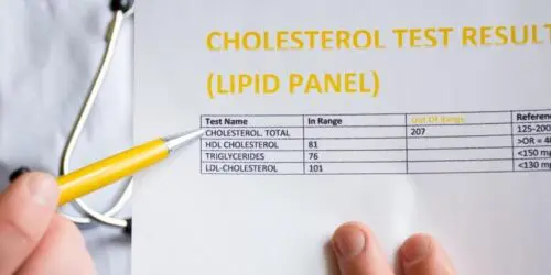 Lipid Panel