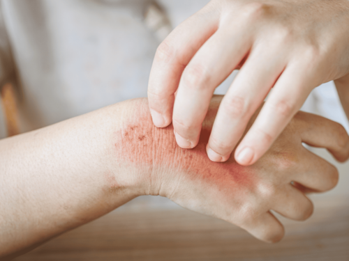 Food additives senstivity testing in Kansas