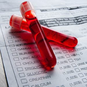 two vials of blood placed on paper work