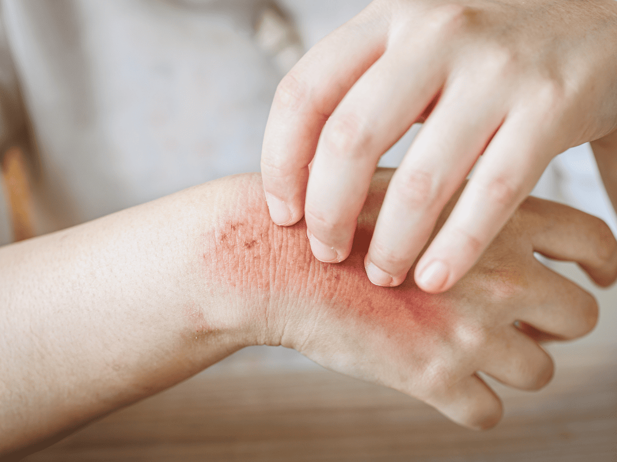 Food additives senstivity testing in Kansas